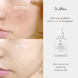 DR. ALTHEA NATURAL RADIANCE ESSENCE 30ML