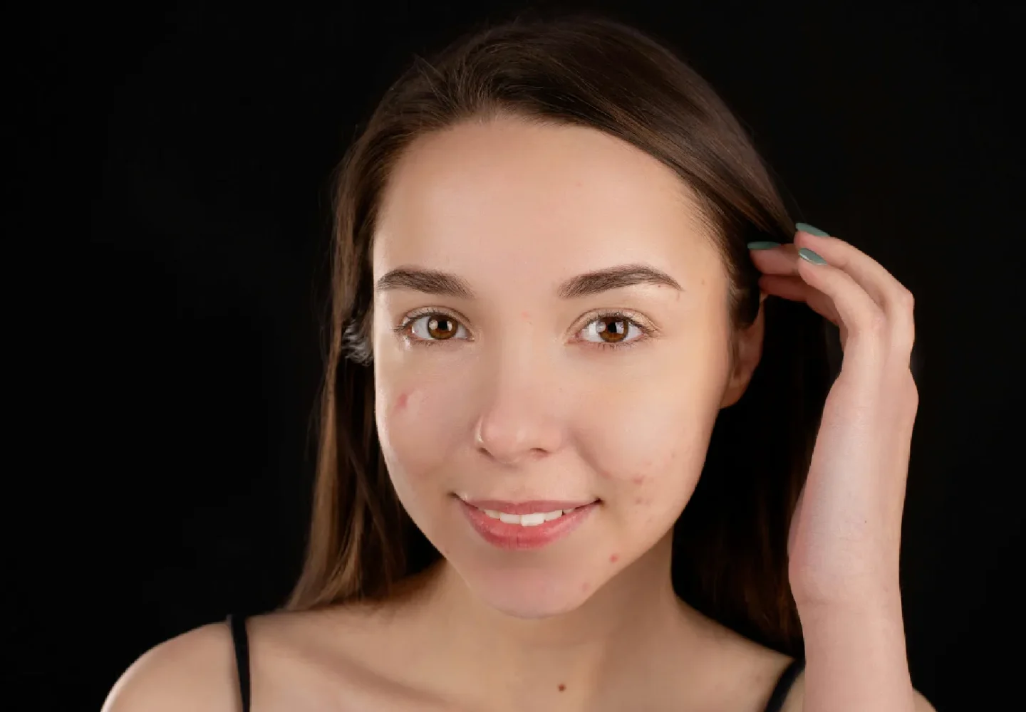 How to Choose a Serum for Acne Prone Skin - Festiva