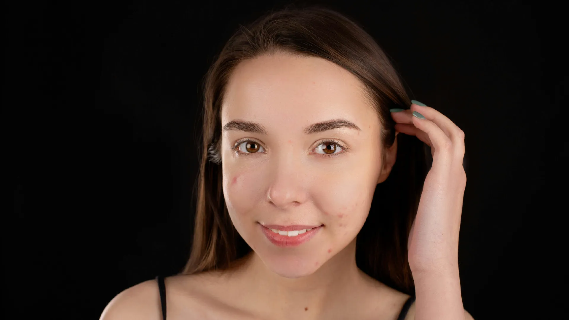 How to Choose a Serum for Acne Prone Skin - Festiva