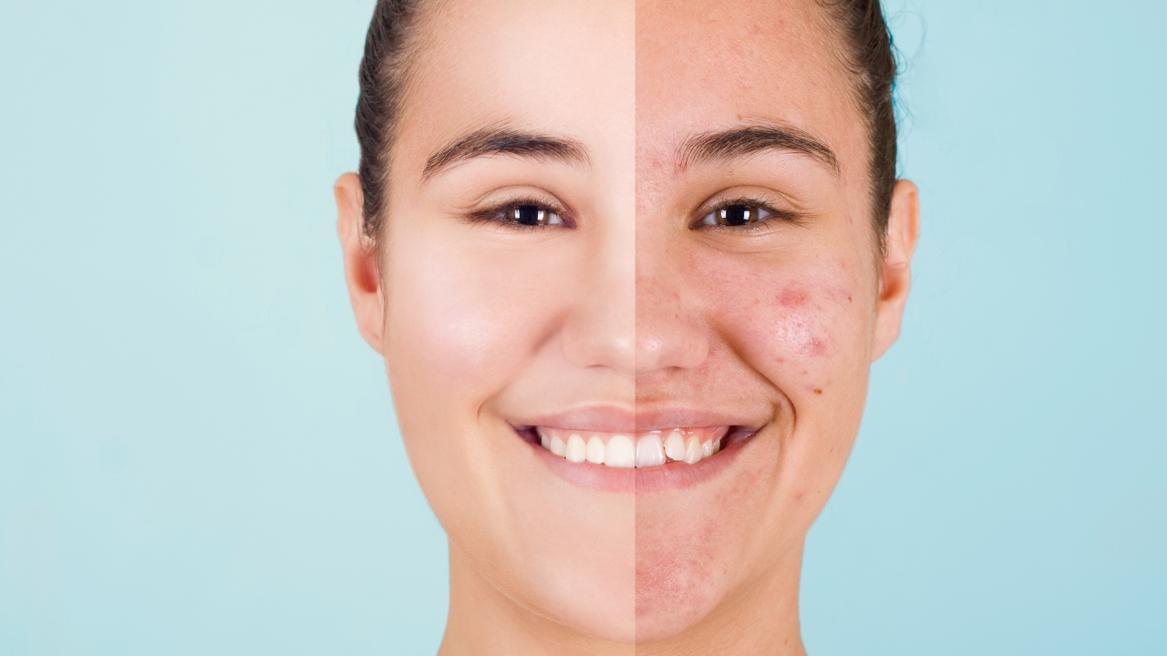 Niacinamide Serum Price in Bangladesh
